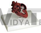 Canine Heart w Heartworm Model